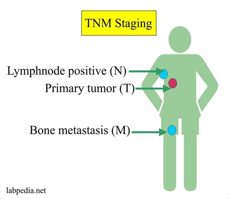 Tumor Marker – Part 1 – Definition Of Tumor Markers Staging And