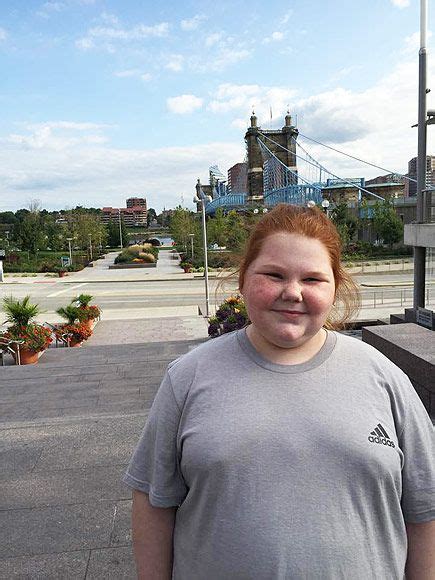 alexis shapiro has brain tumor again after uncontrollable weight gain