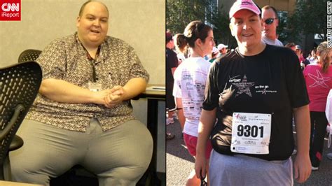 Man Refuses Surgery Drops 270 Pounds