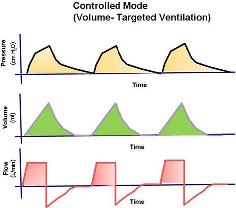 mechanical ventilation types indications complications settings modes