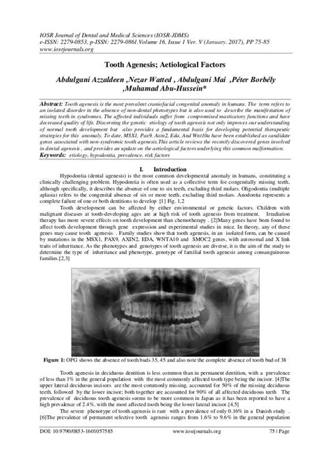 tooth agenesis aetiological factors