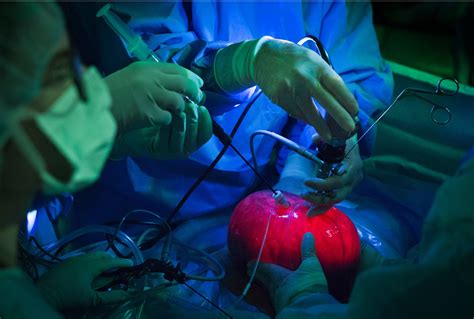 to mend a birth defect surgeons operate on the patient within the