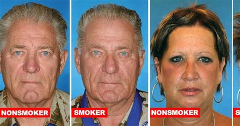 want to quit smoking these pictures of smoker and non