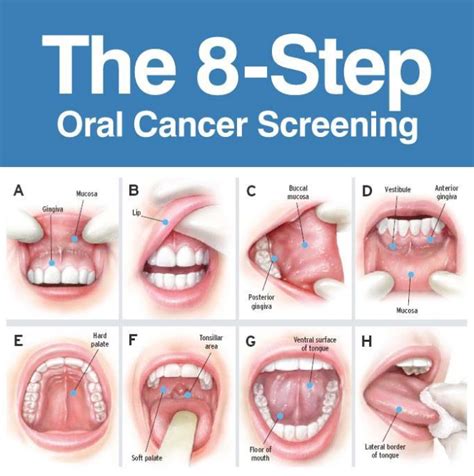 oral cancer awareness early detection  key oral  maxillofacial