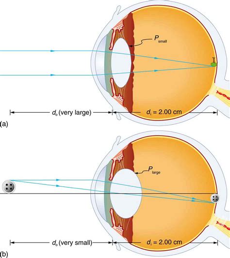 optics question  lenses   human eye physics stack exchange