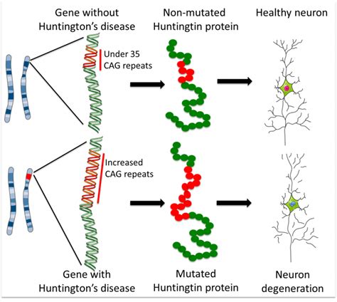 Huntington’s Disease How Could Stem Cells Help Eurostemcell