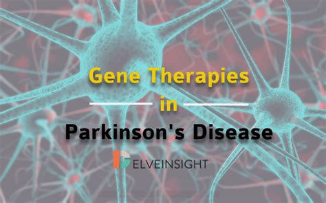 Parkinson S Disease 5 Stages Risk Factors Prevention Gene Therapy