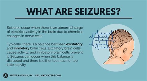Seizures Occur When There Is An Abnormal Surge Of
