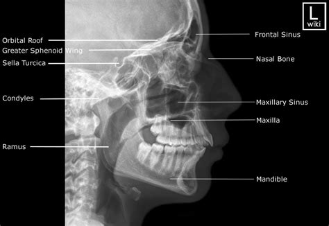 facial bones radiographic anatomy wikiradiography
