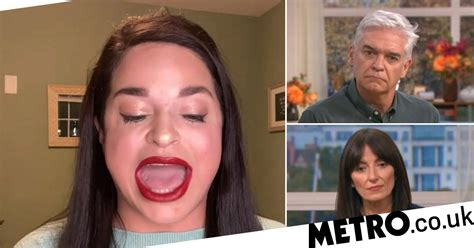 Woman With ‘one Of The Biggest Mouths In The World’ On Being Bullied