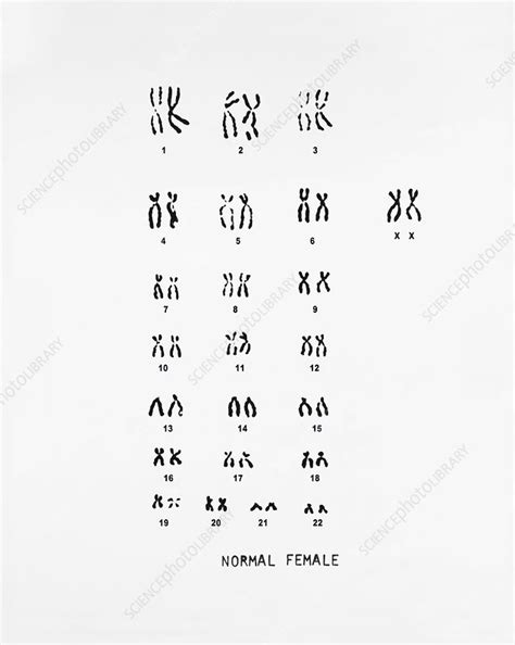 Normal Female Karyotype Stock Image C017 2419 Science Photo Library
