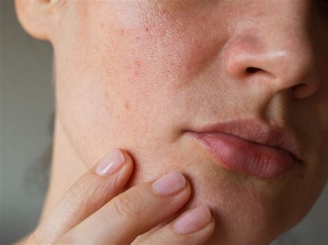 face itchy   bumps allergy trigger