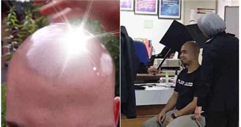Philippines Report Man’s Bald Head Is Too Shiny For