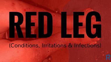 red leg conditions irritations infections