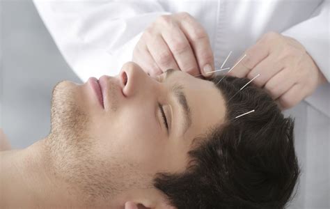 acupuncture outperforms drug  insomnia relief