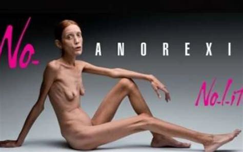 Mi Vida Con Anorexia “llegás A Tener Sexo Sólo Para Bajar Unos Gramos