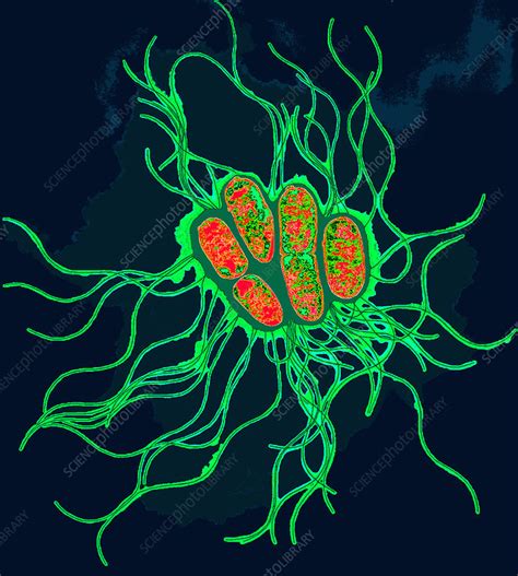coloured tem  salmonella bacteria stock image  science
