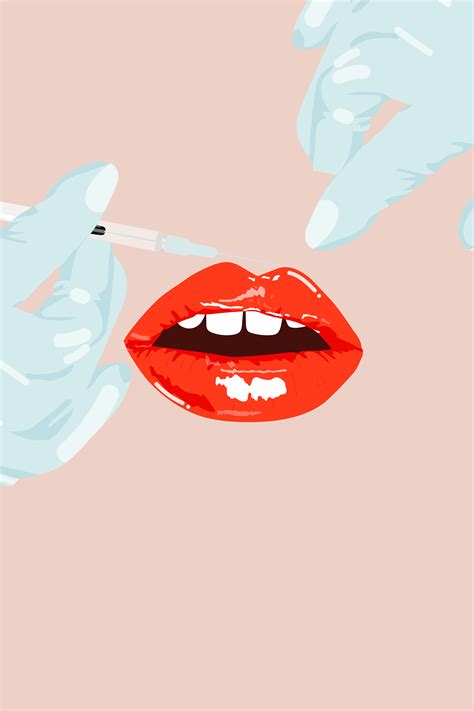 what are lip injections lip fillers guide