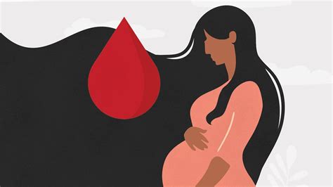 uterus removal for postpartum bleeding is too common everyday health
