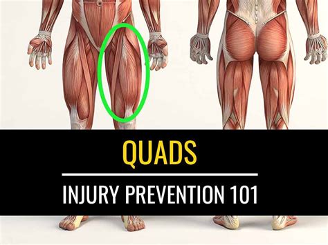 injury prevention   quads exercises sports injury physio