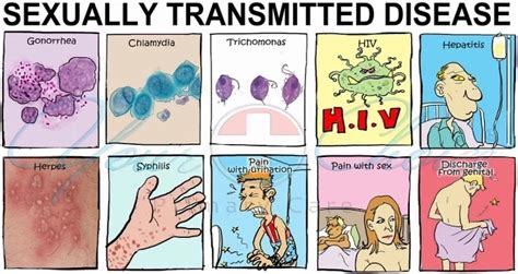 sexually transmitted diseases stds types and symptoms