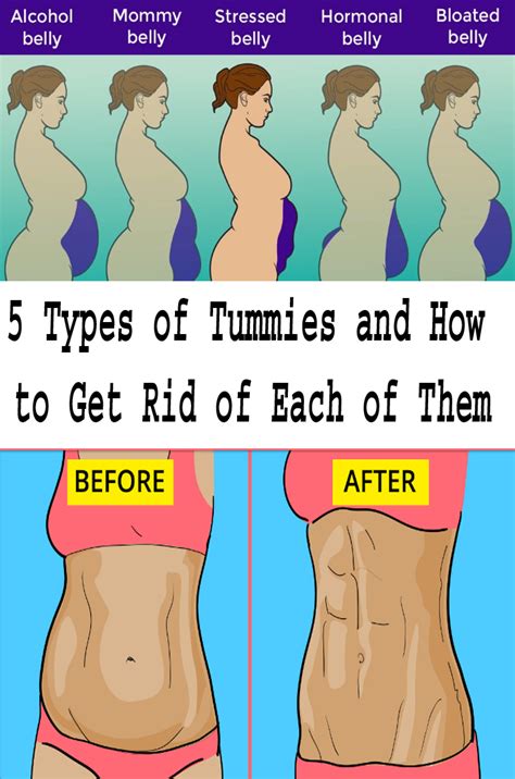 5 types of tummies and how to get rid of each of them