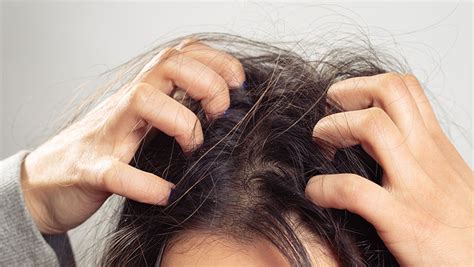 ways    care   dry scalp currie hair skin  nails