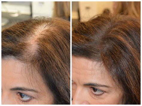 instant coverage of roots and thinning patches new
