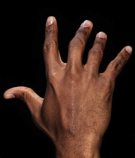Chris Pauls Fast Hands And Gruesome Fingers The New York Times