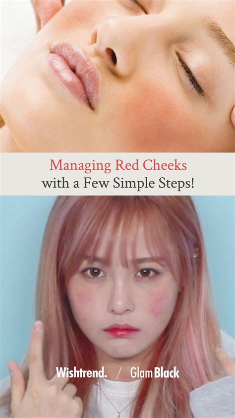 managing red cheeks    simple steps