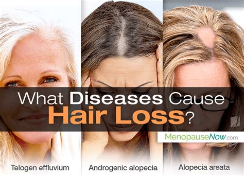 hair diseases  hair loss menopause