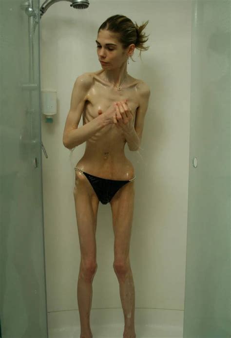 pictures of anorexic and body mutilation