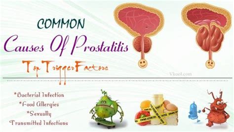 common causes of prostatitis top 11 trigger factors