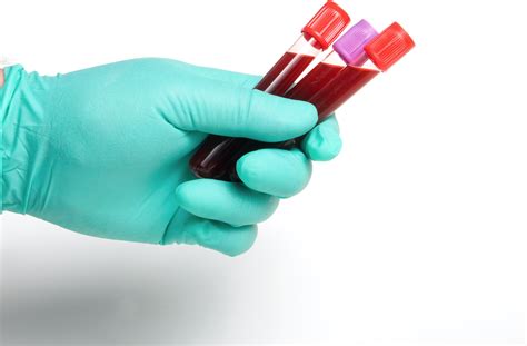 phlebotomy advice financial tribune