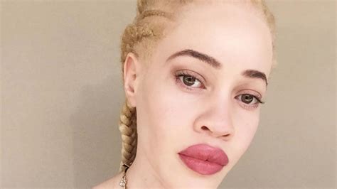 wet n wild chose a model with albinism to front their next