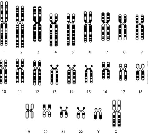 Diagrammatical Representation Of The Human Karyotype Of