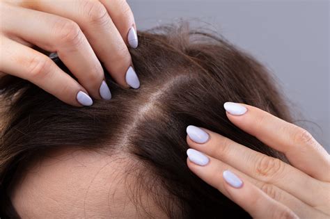tipps gegen duenne haare  wird die haarpracht voller lockenstabcom