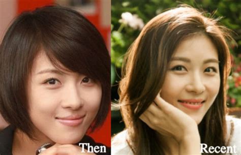Ha Ji Won Plastic Surgery Before And After Photos Latest
