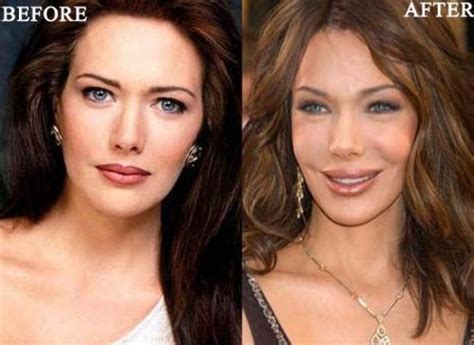 Hunter Tylo Plastic Surgery Was Trouble And Mistake Actress