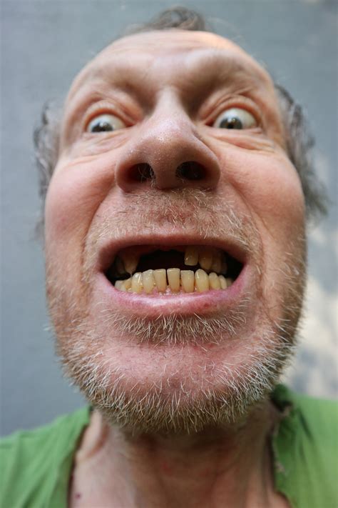 missing teeth  stock photo public domain pictures