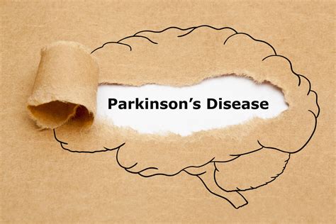 worlds  biomarker  efficient parkinsons disease diagnosis   lead