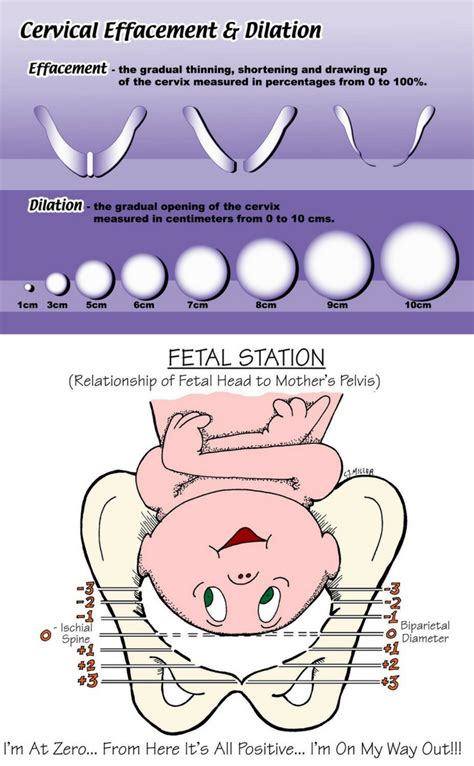 cervical effacement  dilation chart  fetal station image