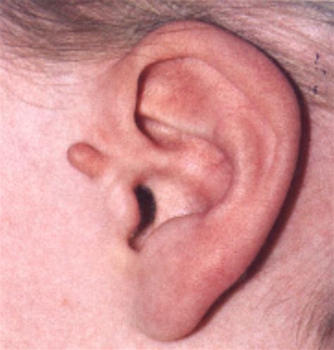 abc  general surgery  children lumps  swellings   head  neck  bmj