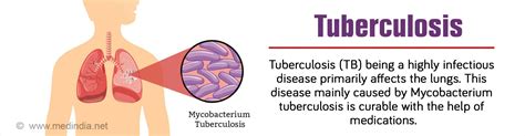 tuberculosis spread symptoms diagnosis treatment faqs
