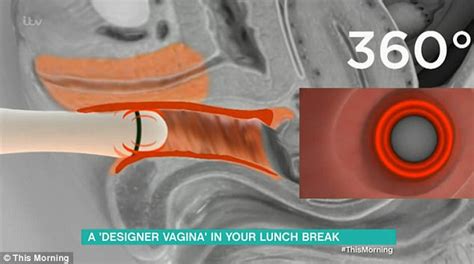 itv this morning shows designer vagina procedure live daily mail online