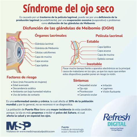 síndrome del ojo seco infografía