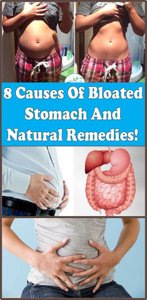 8 Causes Of Bloated Stomach And Natural Remedies In 2021 Bloated