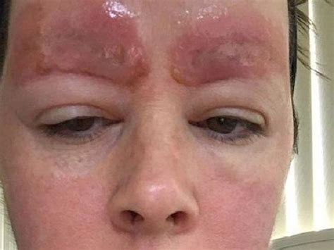 Melbourne Salon Sues For 150k After Woman Posts Photos Of Eyebrow