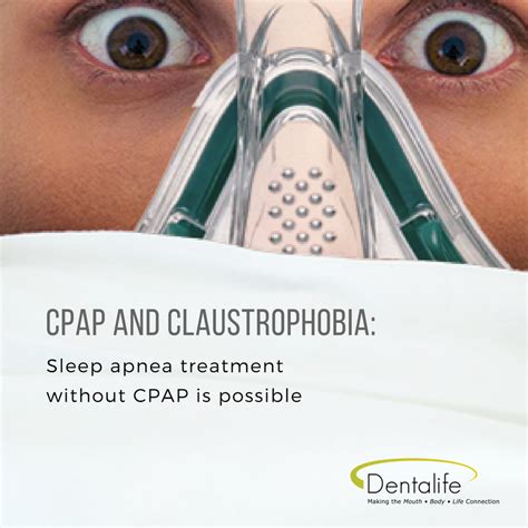 Cpap And Claustrophobia Treat Sleep Apnea Without Cpap