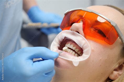 Classical Dental Coloring For Determining Color Of Teeth Banner Tooth